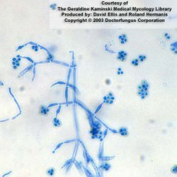 Trichoderma sp.