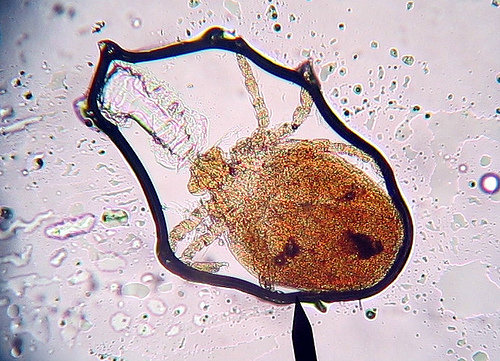 Chigger under microscope